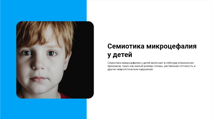[Презентация] Семиотика микроцефалия у детей