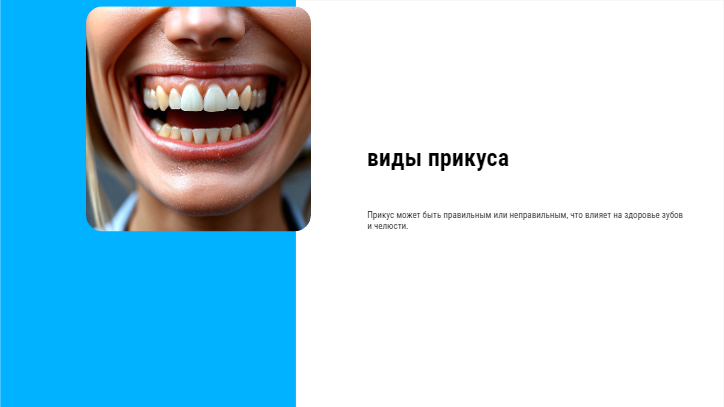 [Презентация] виды прикуса